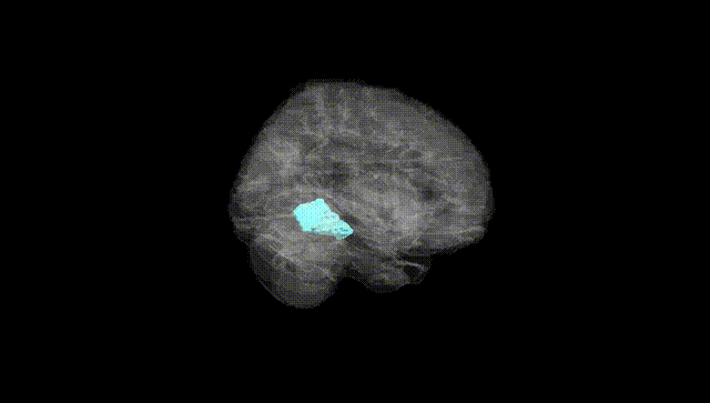 Full Brain Black