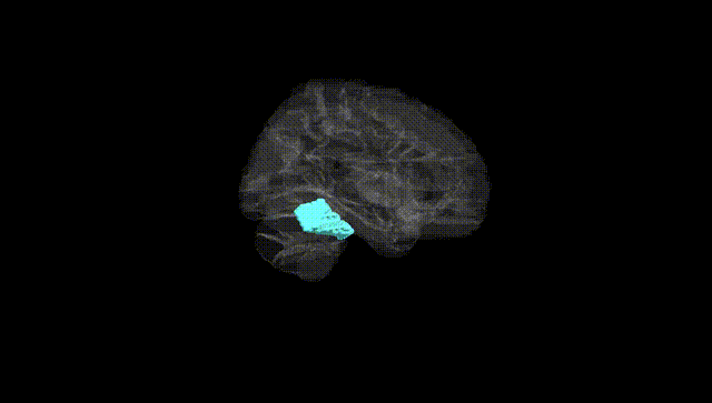 Hemisphere Black