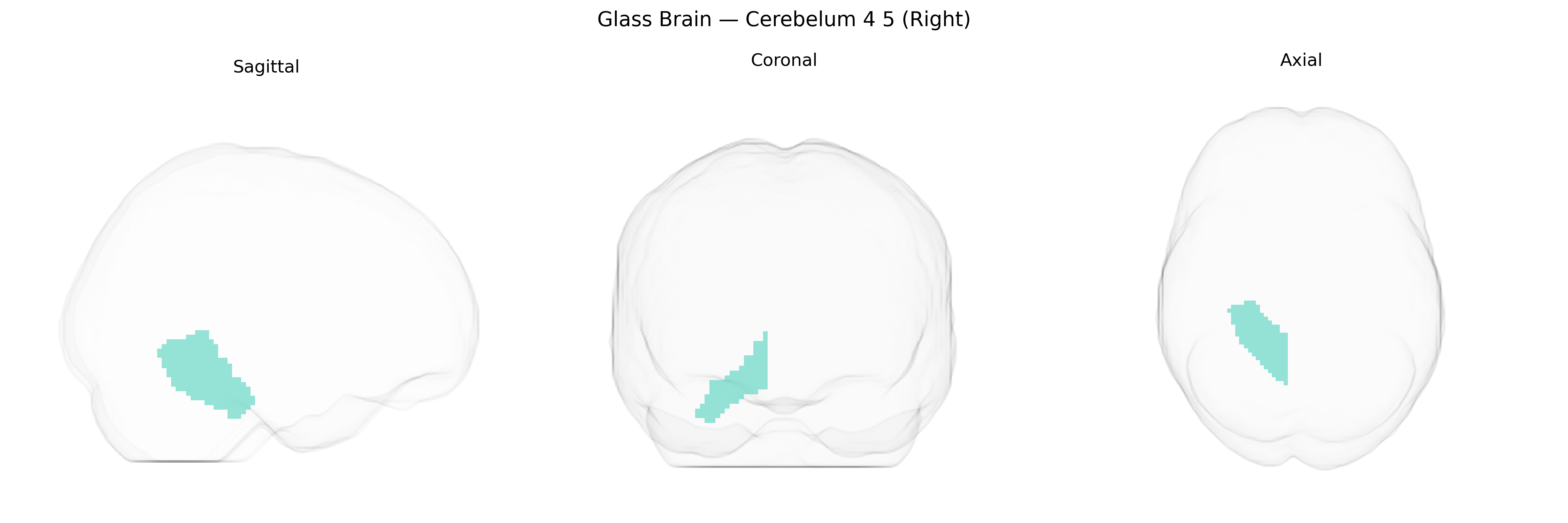 Triplanar Ghost Brain