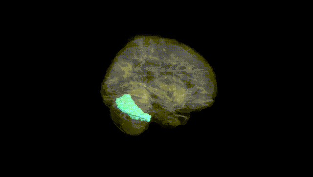 Full Brain Black