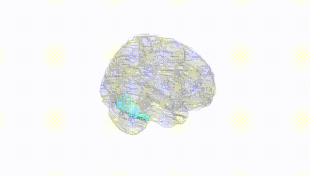 Full Brain White