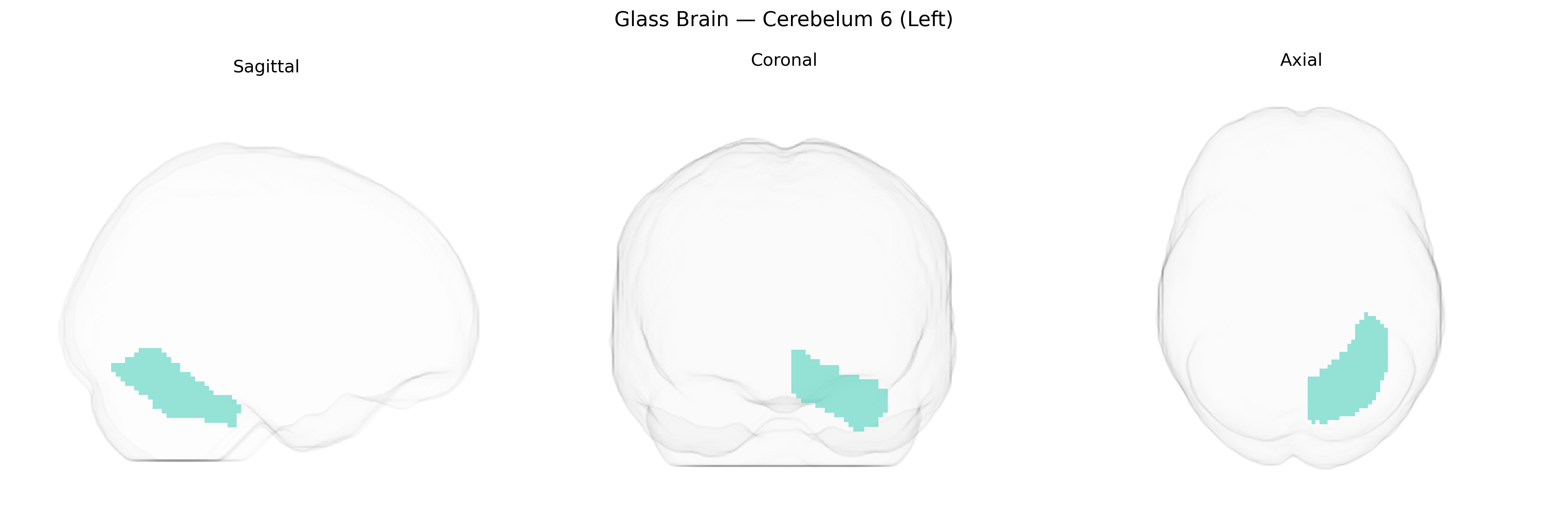 Triplanar Ghost Brain