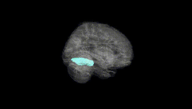 Full Brain Black