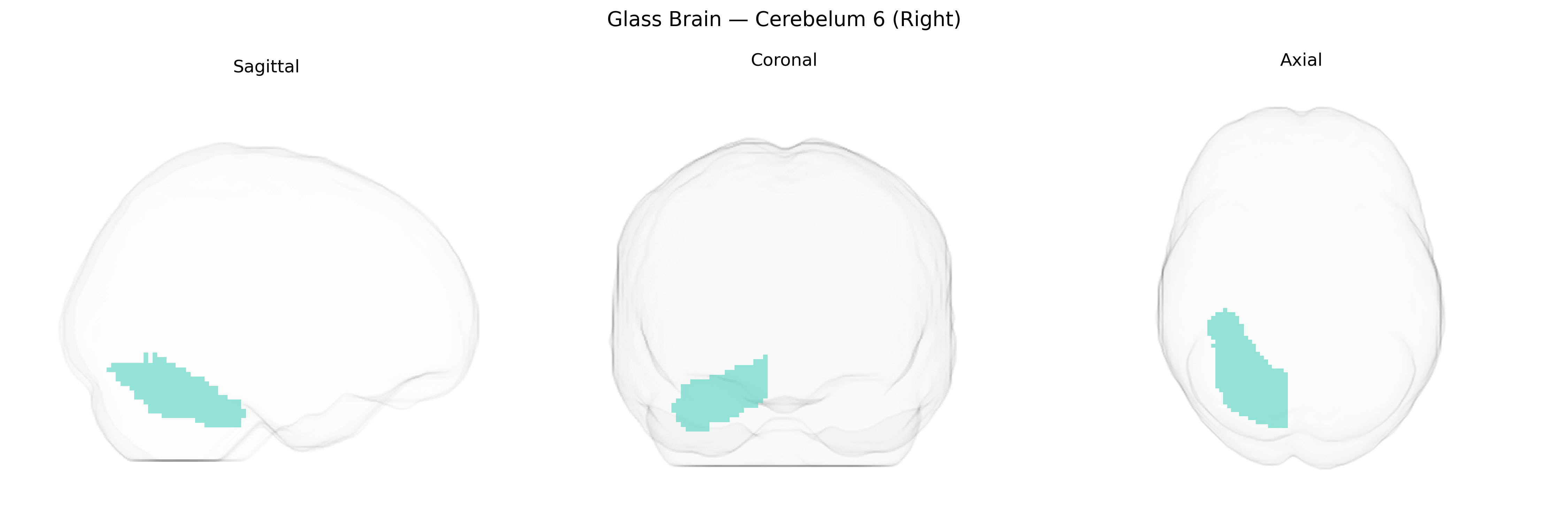 Triplanar Ghost Brain