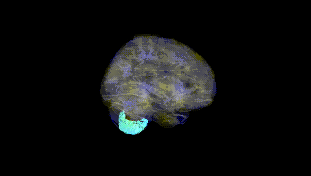 Full Brain Black