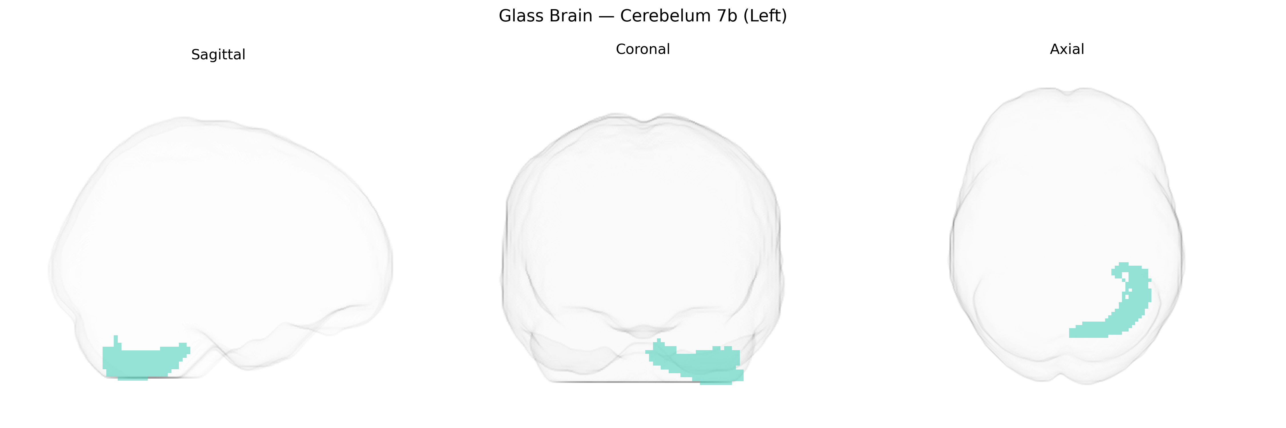 Triplanar Ghost Brain