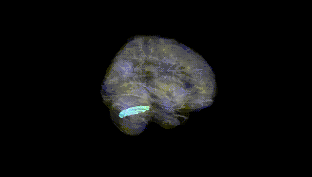 Full Brain Black