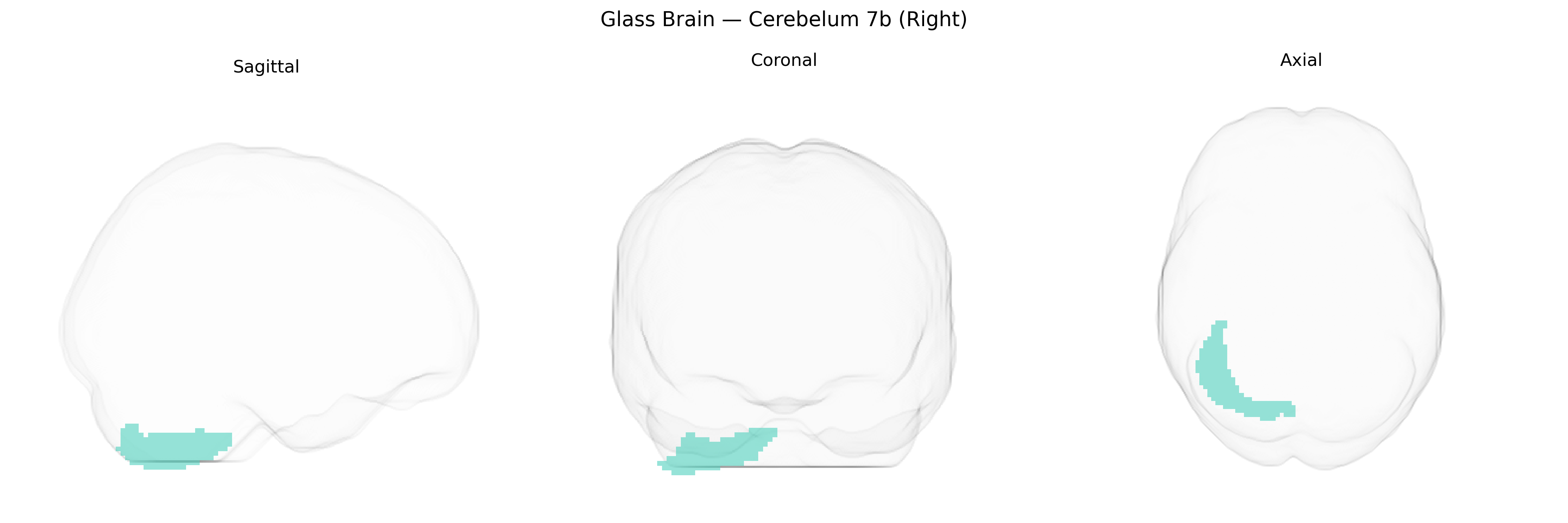 Triplanar Ghost Brain