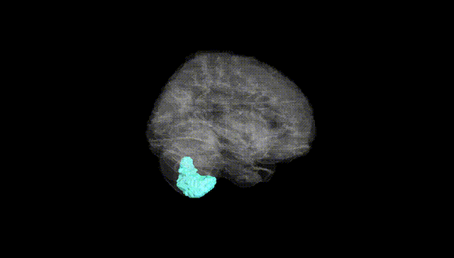 Full Brain Black