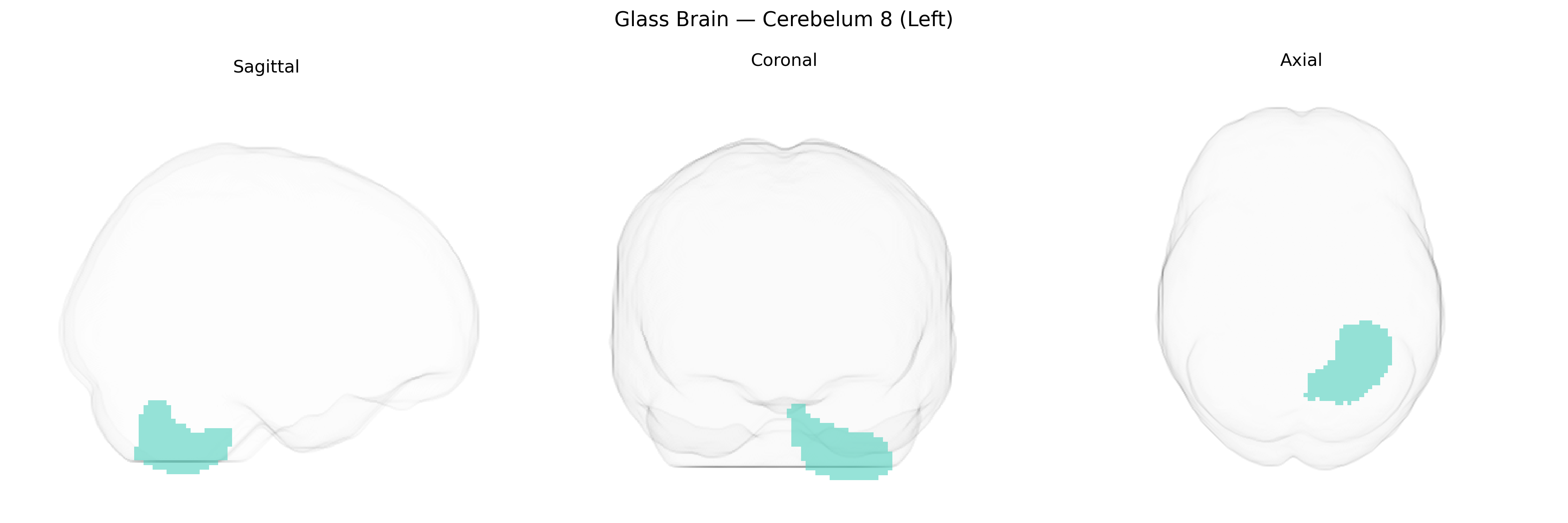 Triplanar Ghost Brain