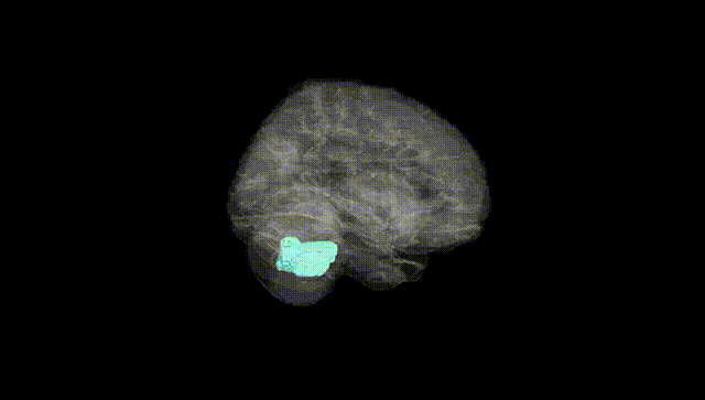 Full Brain Black