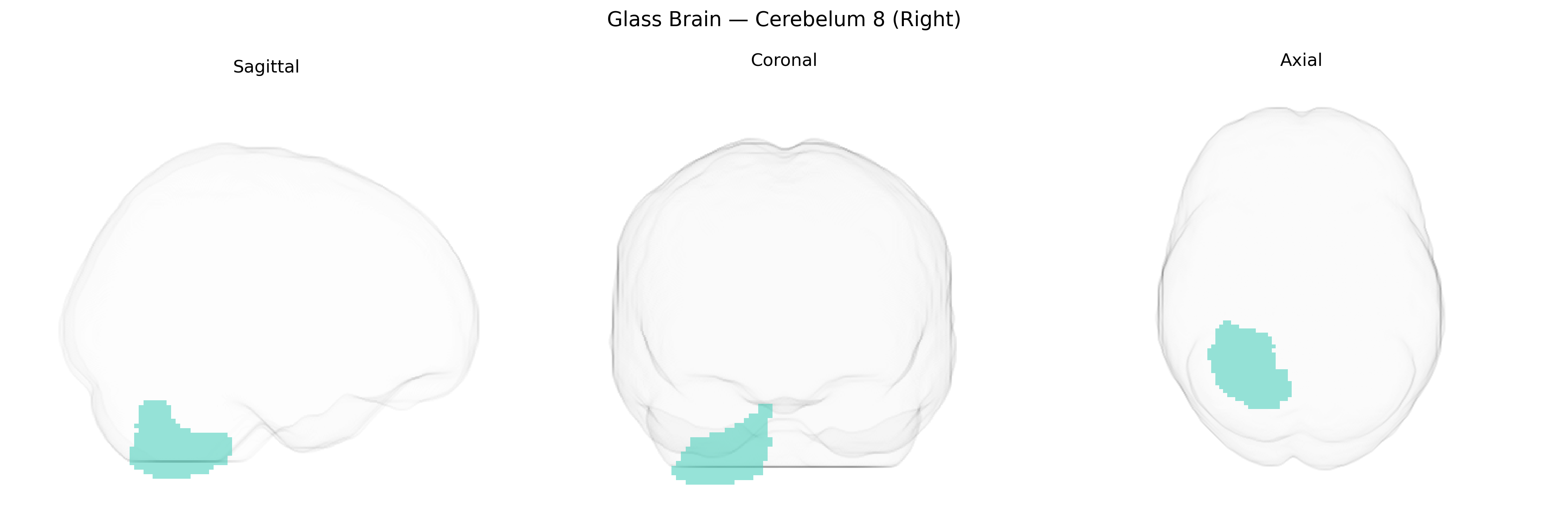 Triplanar Ghost Brain