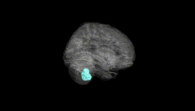 Full Brain Black