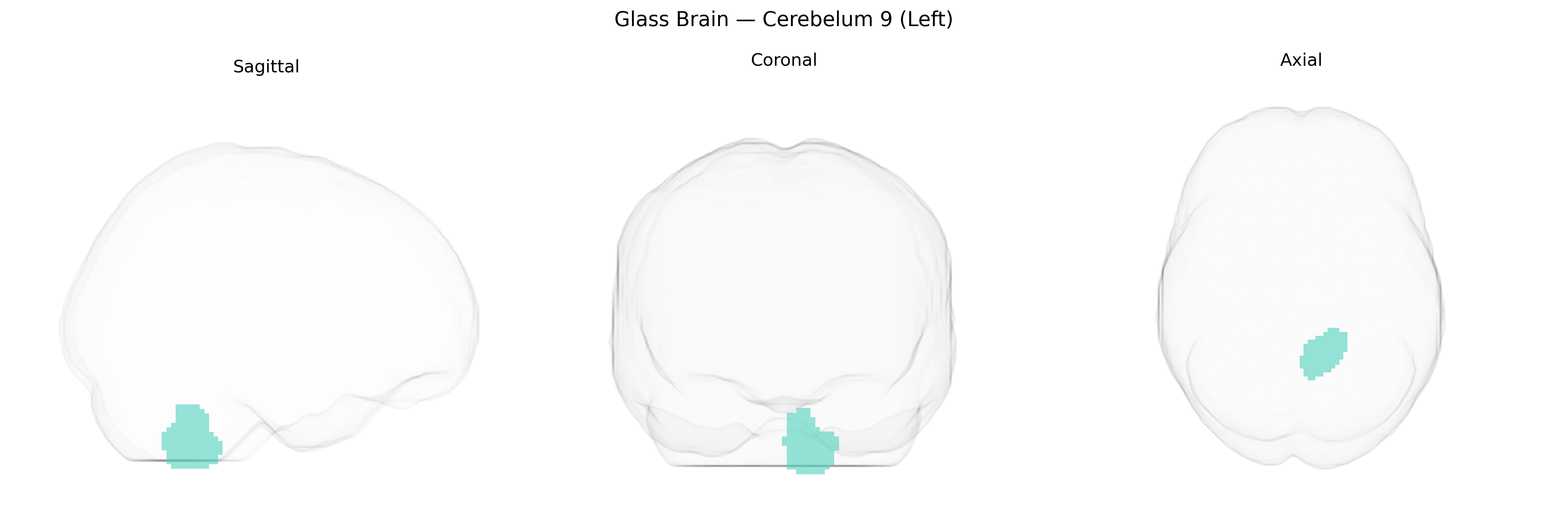 Triplanar Ghost Brain