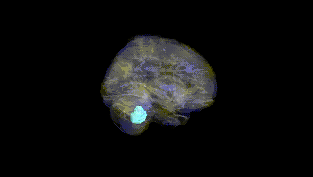 Full Brain Black