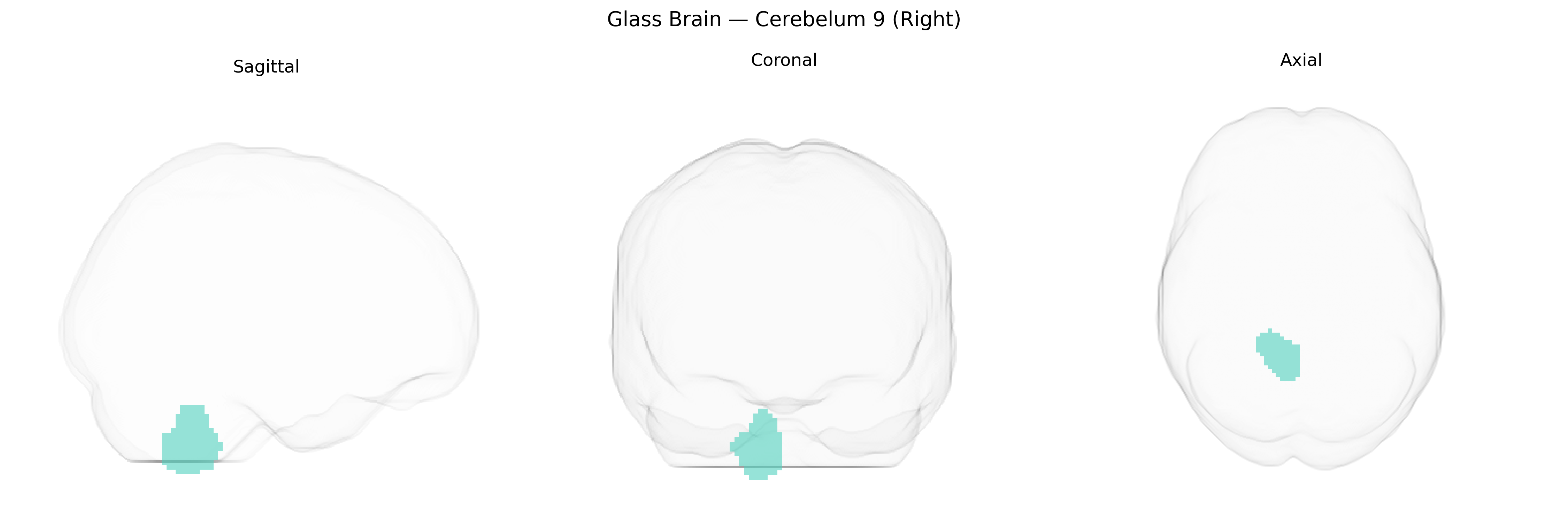 Triplanar Ghost Brain