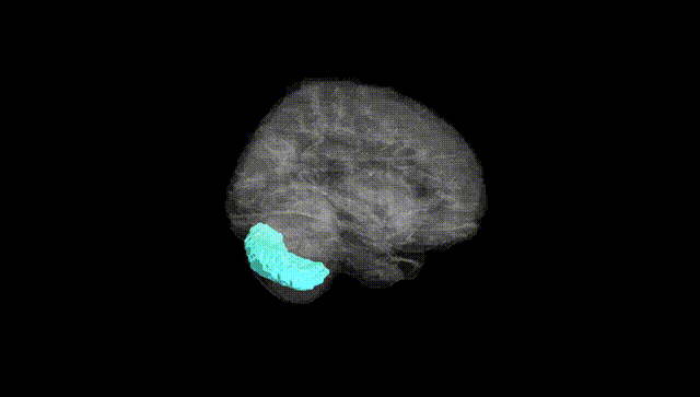 Full Brain Black