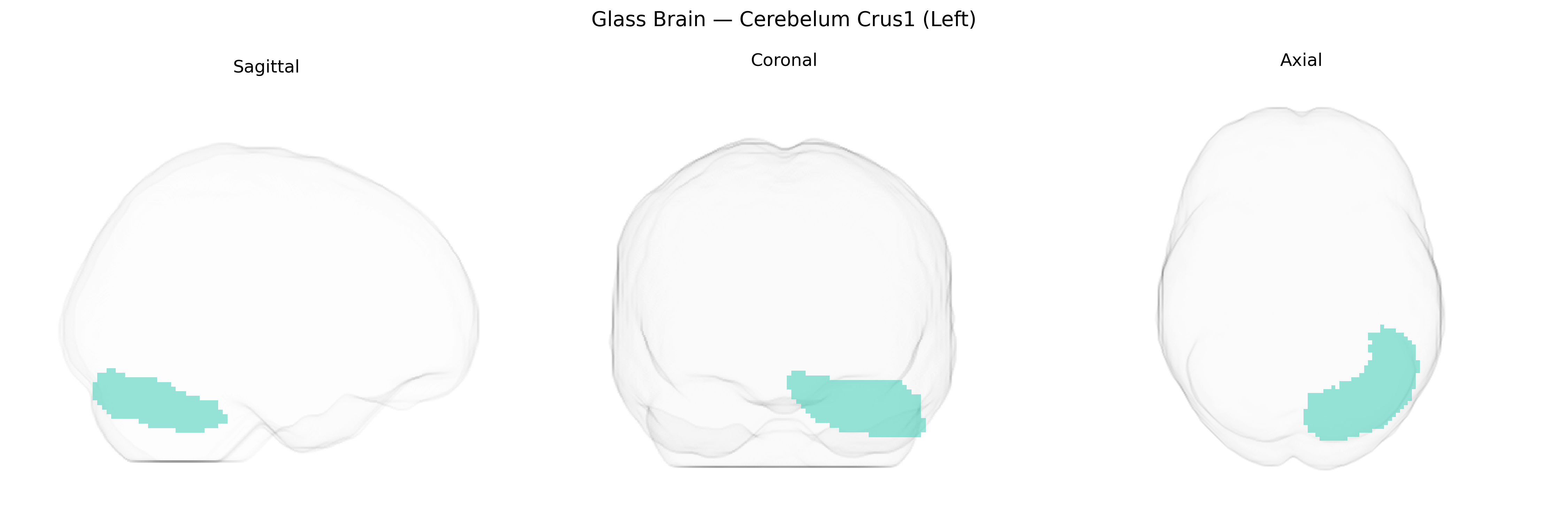 Triplanar Ghost Brain