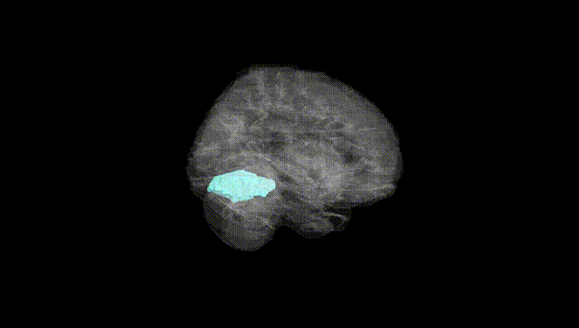 Full Brain Black