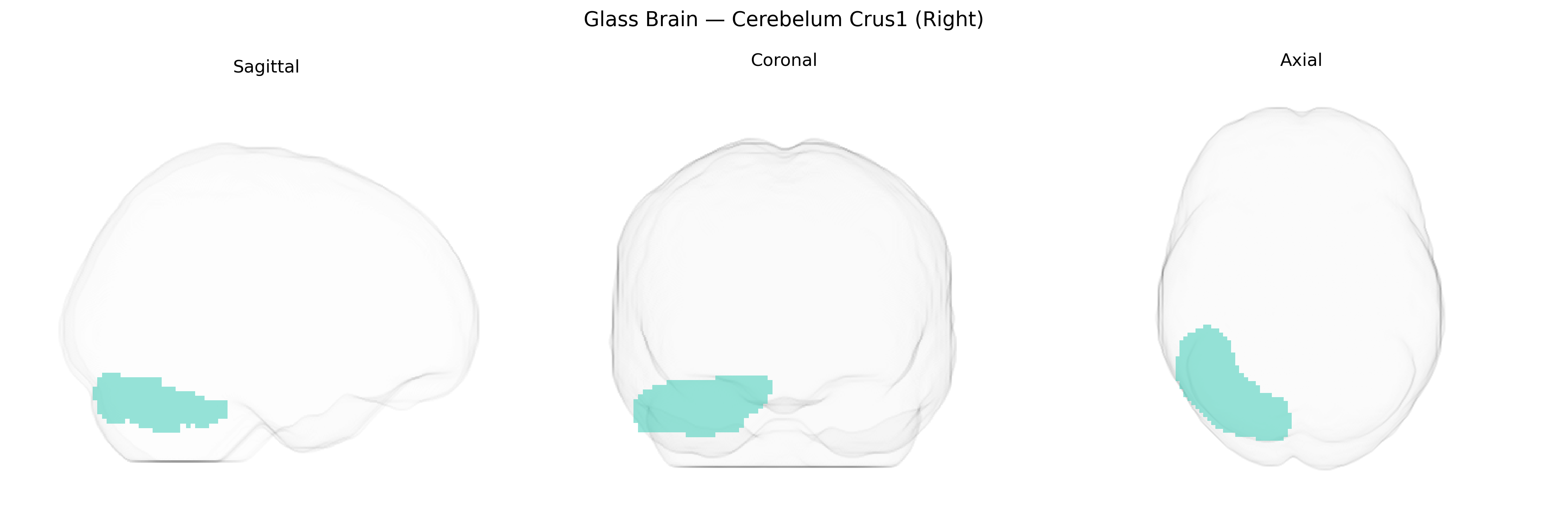 Triplanar Ghost Brain