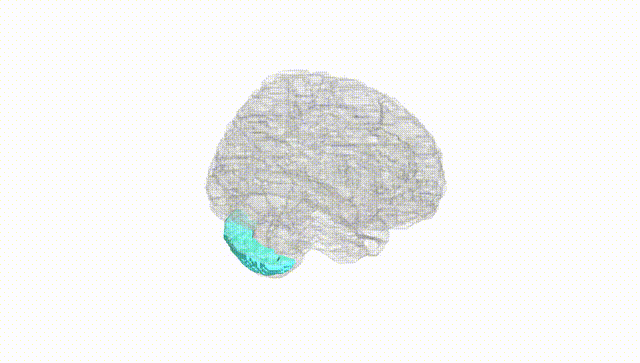Full Brain White