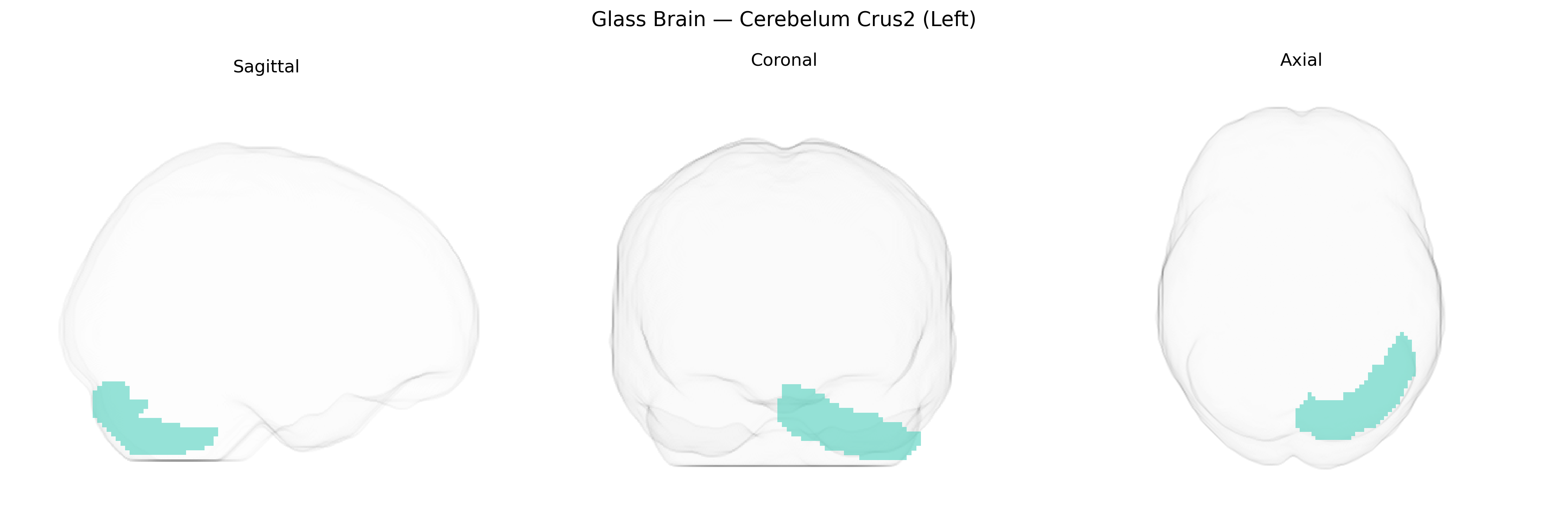 Triplanar Ghost Brain