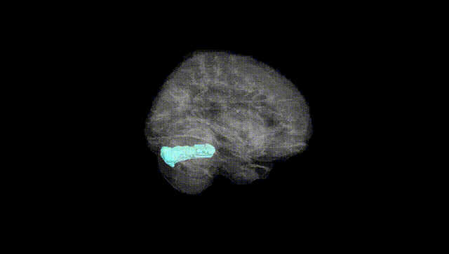 Full Brain Black