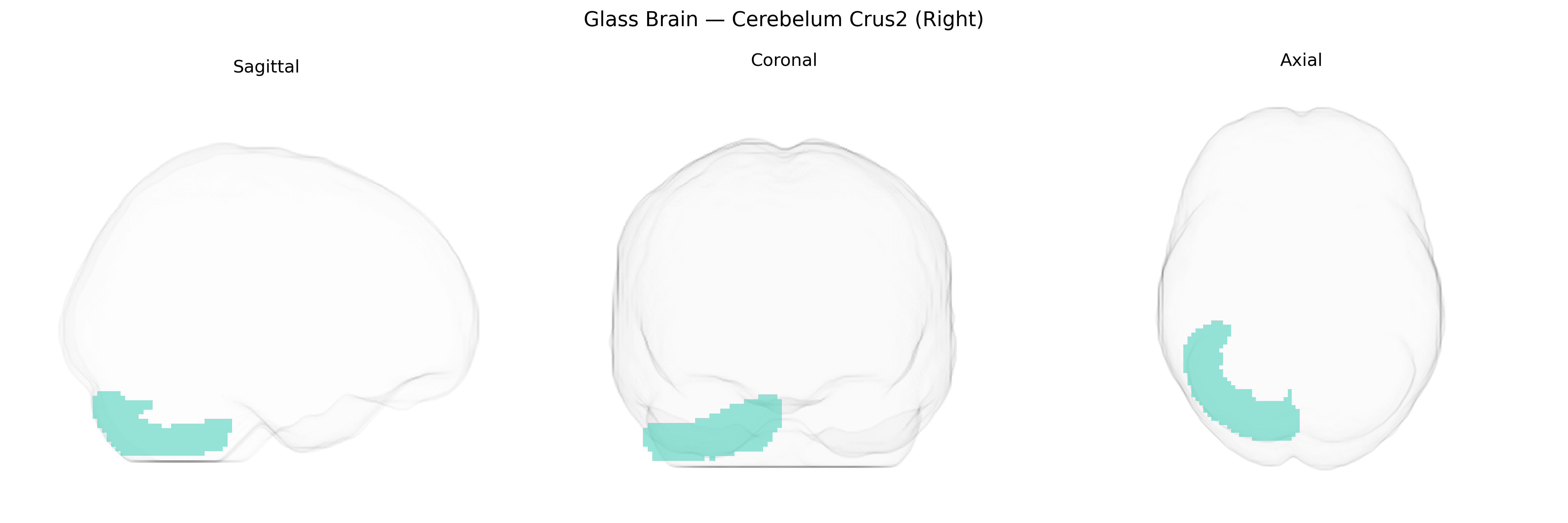 Triplanar Ghost Brain