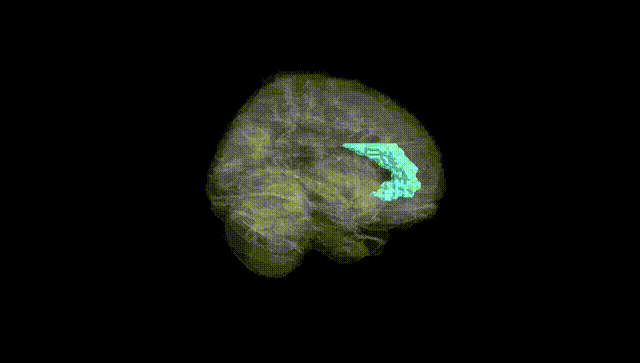 Full Brain Black