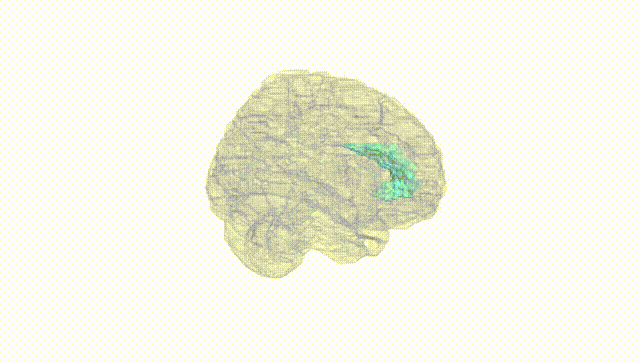 Full Brain White