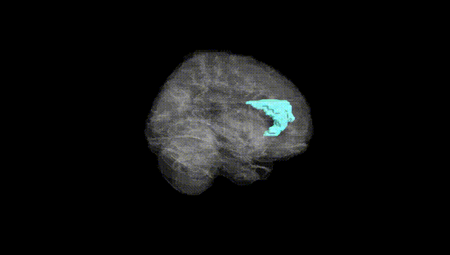 Full Brain Black