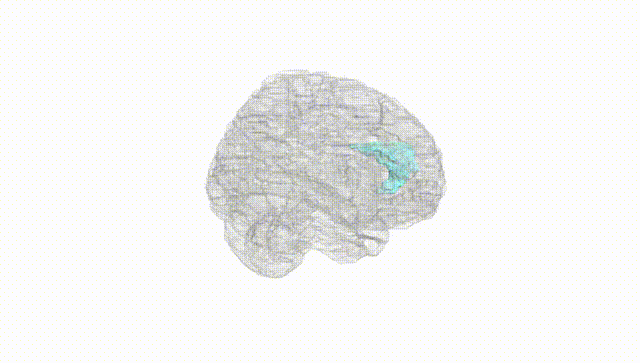 Full Brain White