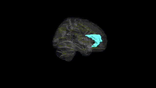 Hemisphere Black