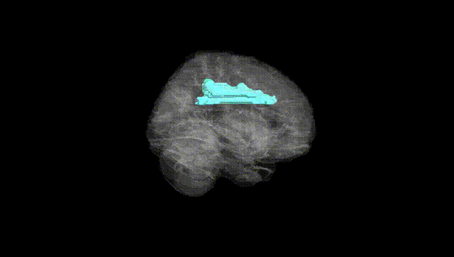 Full Brain Black