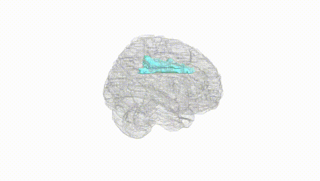 Full Brain White