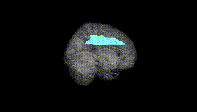 Full Brain Black