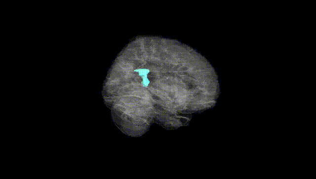 Full Brain Black