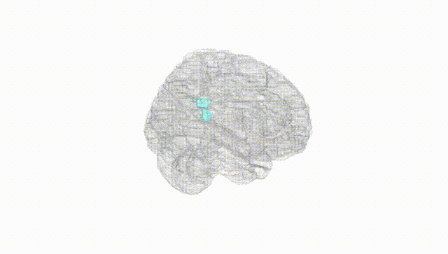 Full Brain White