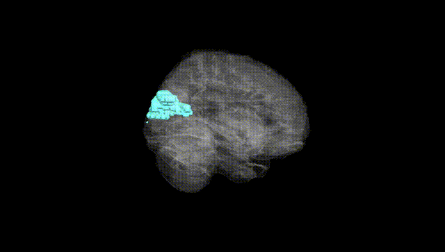 Full Brain Black