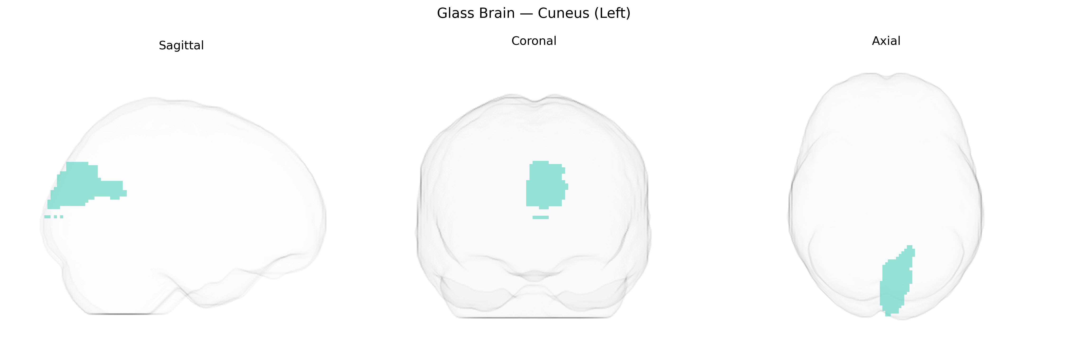 Triplanar Ghost Brain