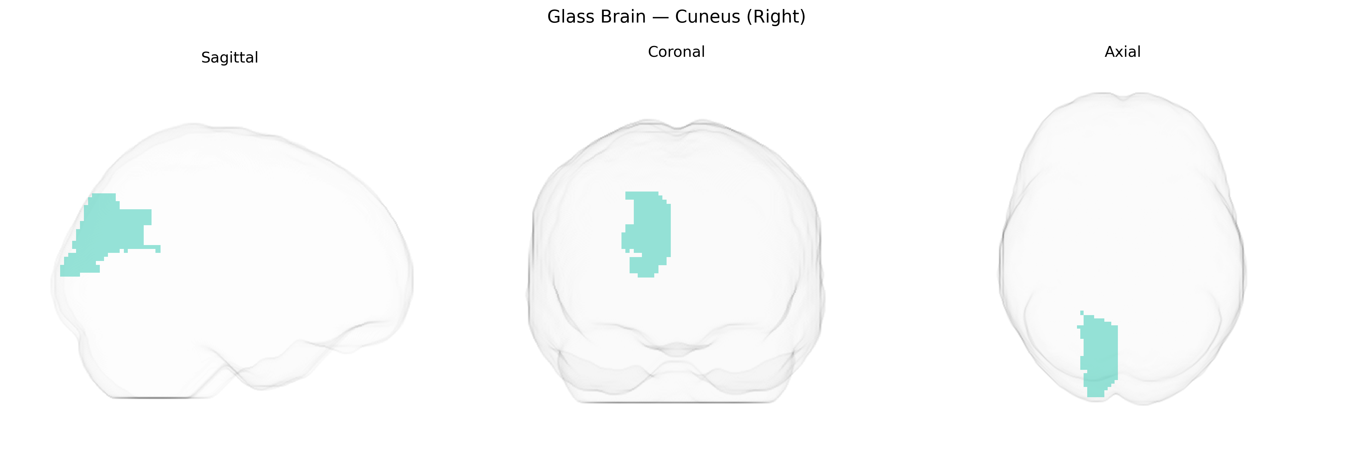 Triplanar Ghost Brain