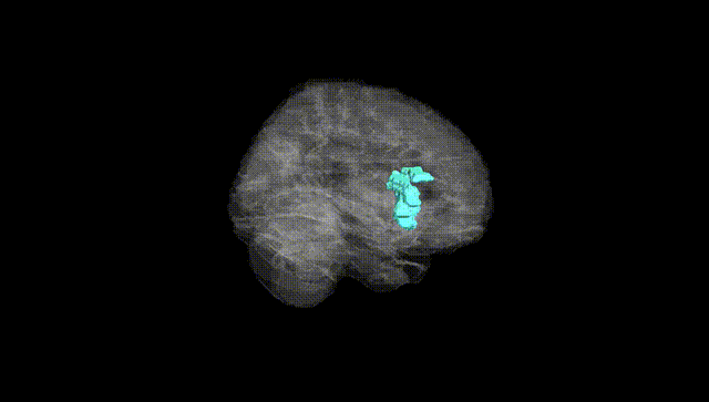 Full Brain Black