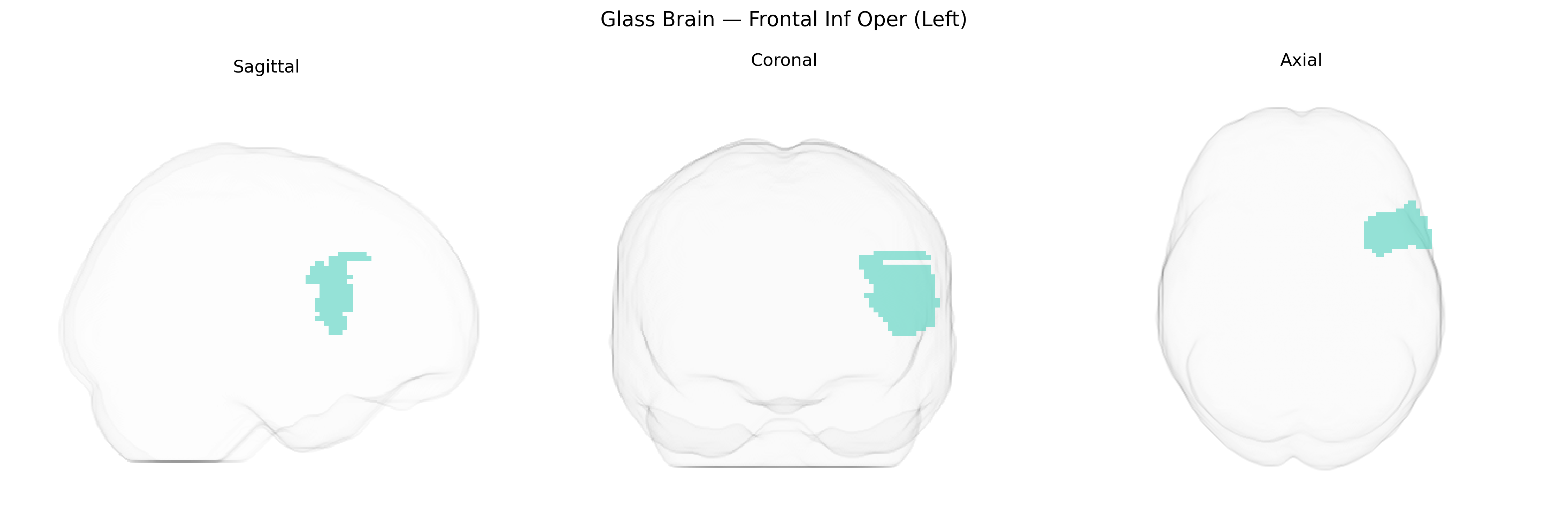 Triplanar Ghost Brain