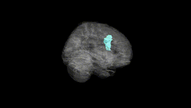 Full Brain Black