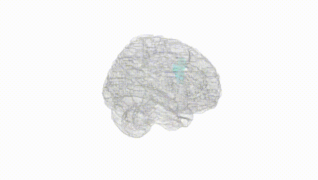 Full Brain White