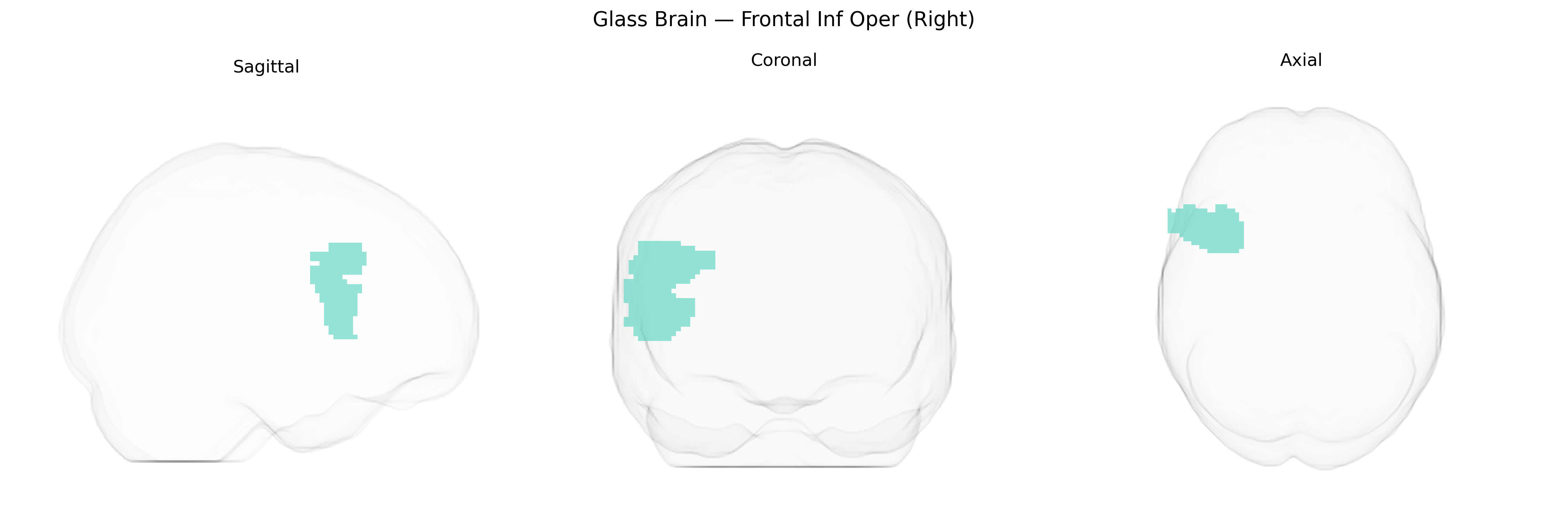 Triplanar Ghost Brain