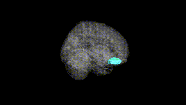 Full Brain Black