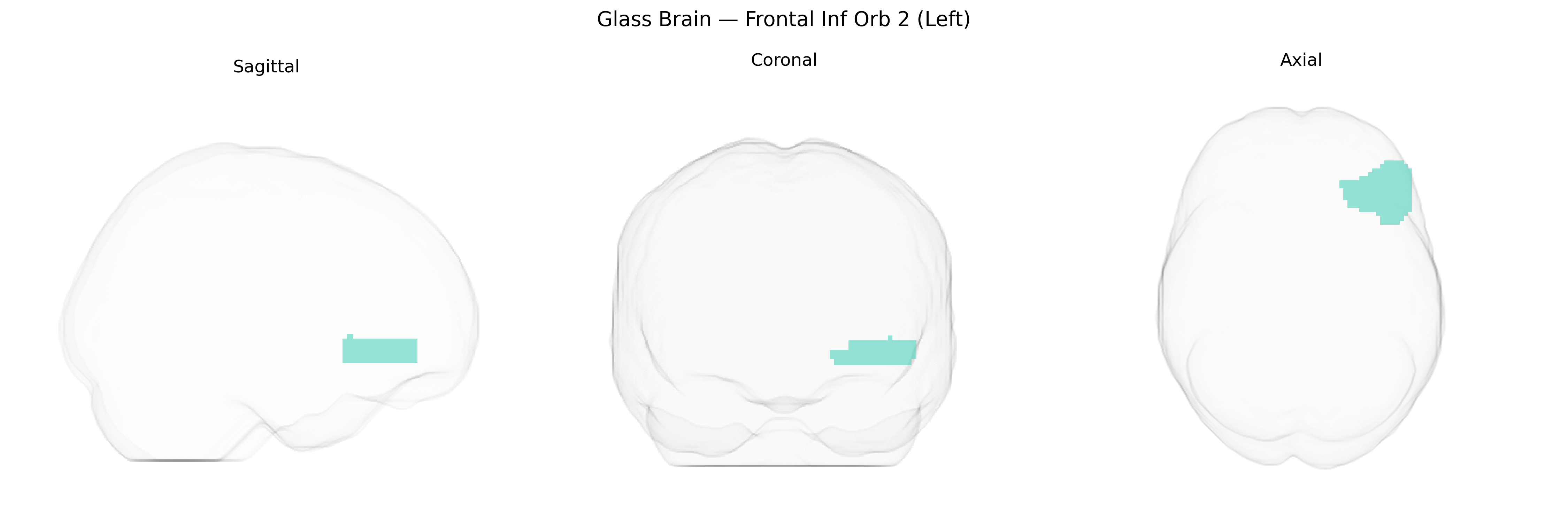 Triplanar Ghost Brain