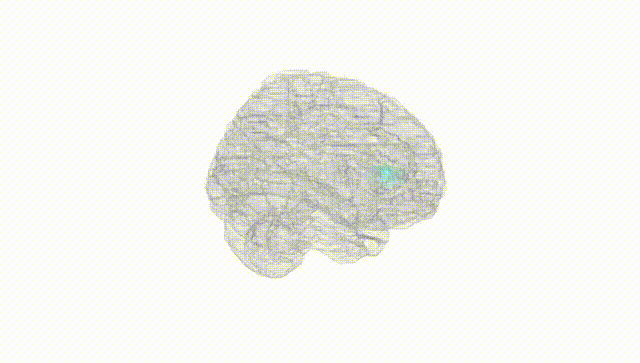 Full Brain White