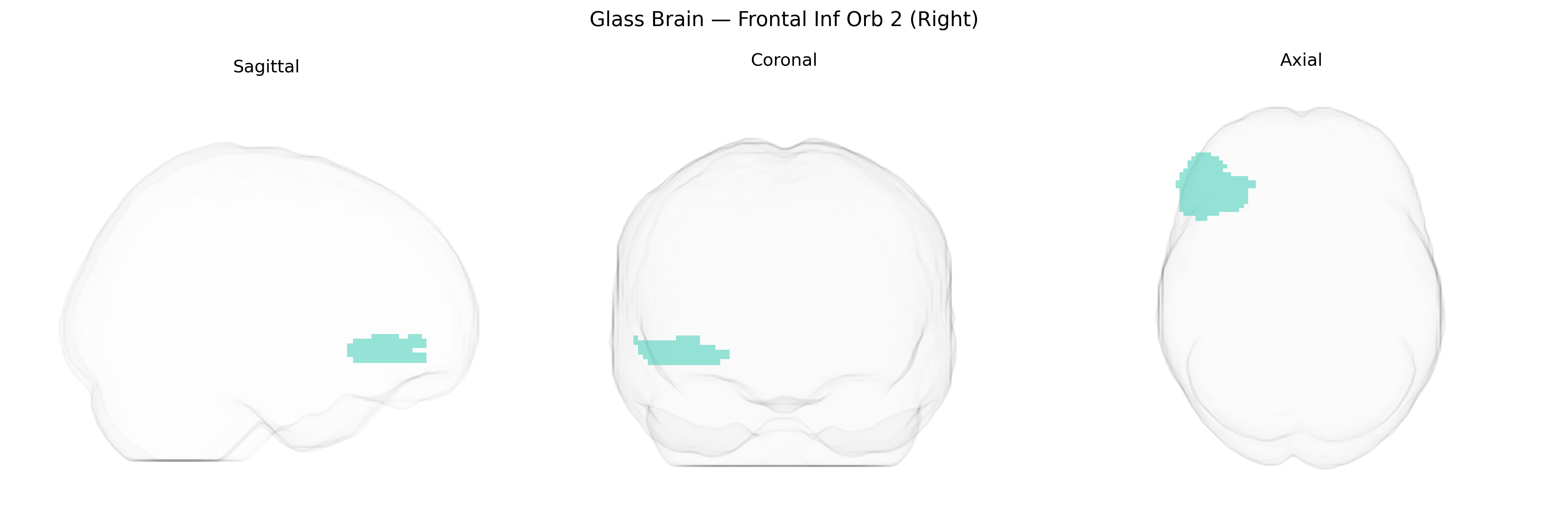 Triplanar Ghost Brain